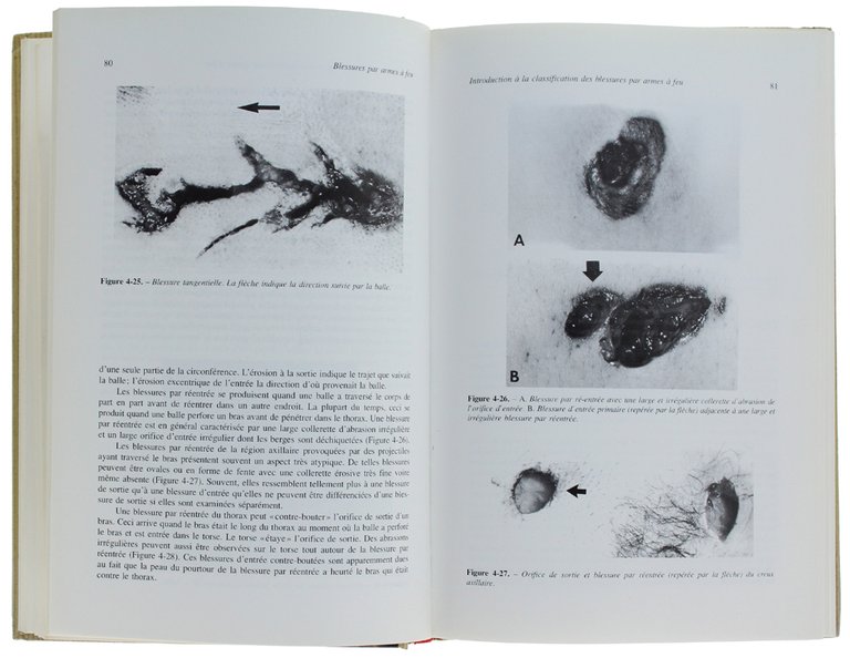 BLESSURES PAR ARMES À FEU: Aspects pratiques des armes à …