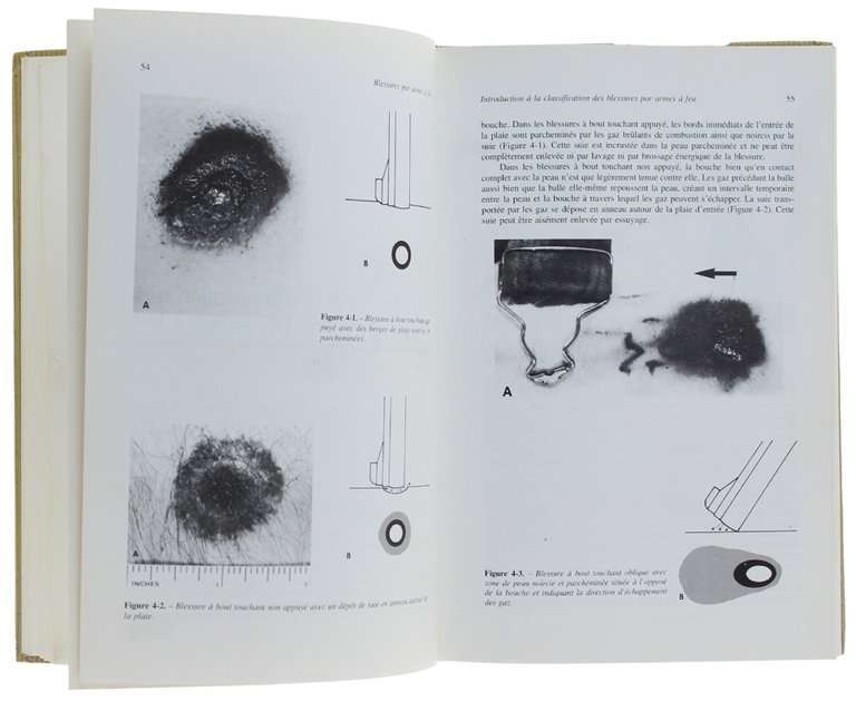 BLESSURES PAR ARMES À FEU: Aspects pratiques des armes à …