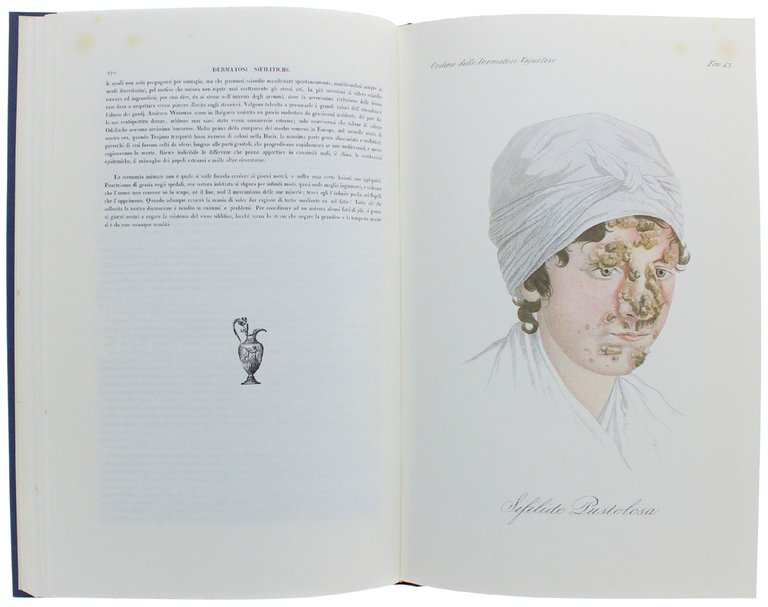 CLINICA DEL PARIGINO SPEDALE DI S. LUIGI OSSIA TRATTATO COMPIUTO …