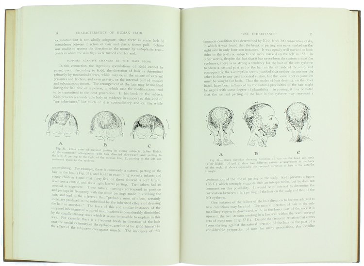 HAIR - With Special Reference to Hypertrichosos.