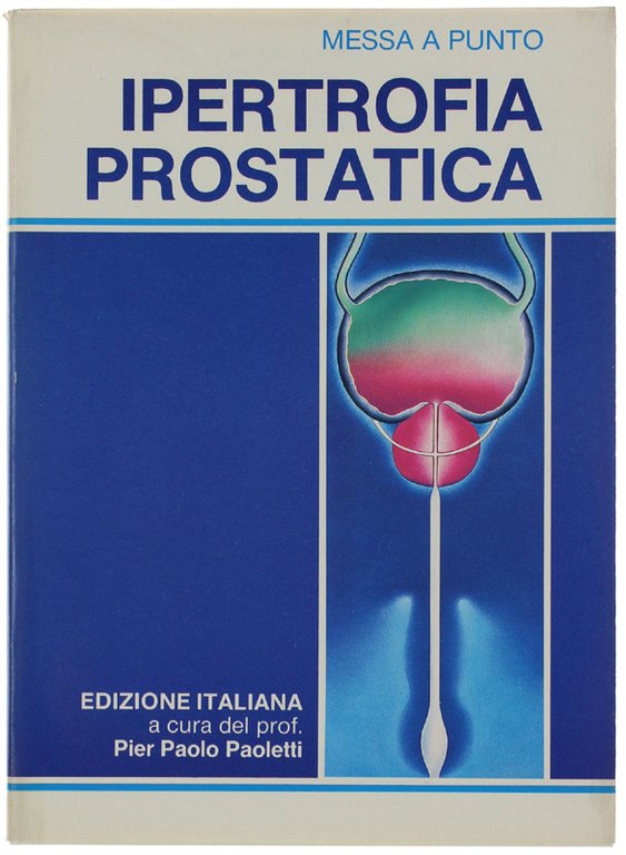 IPERTROFIA PROSTATICA. Messa a punto.