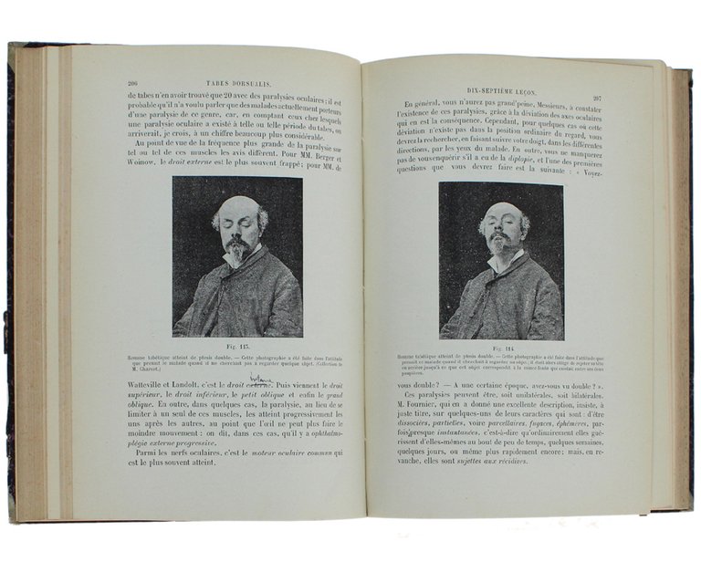 LEÇONS SUR LES MALADIES DE LA MOELLE.