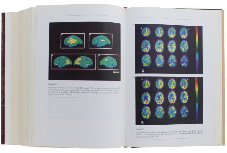 MANUALE DI NEUROPSICOLOGIA. Normalità e patologia dei processi cognitivi [2a …