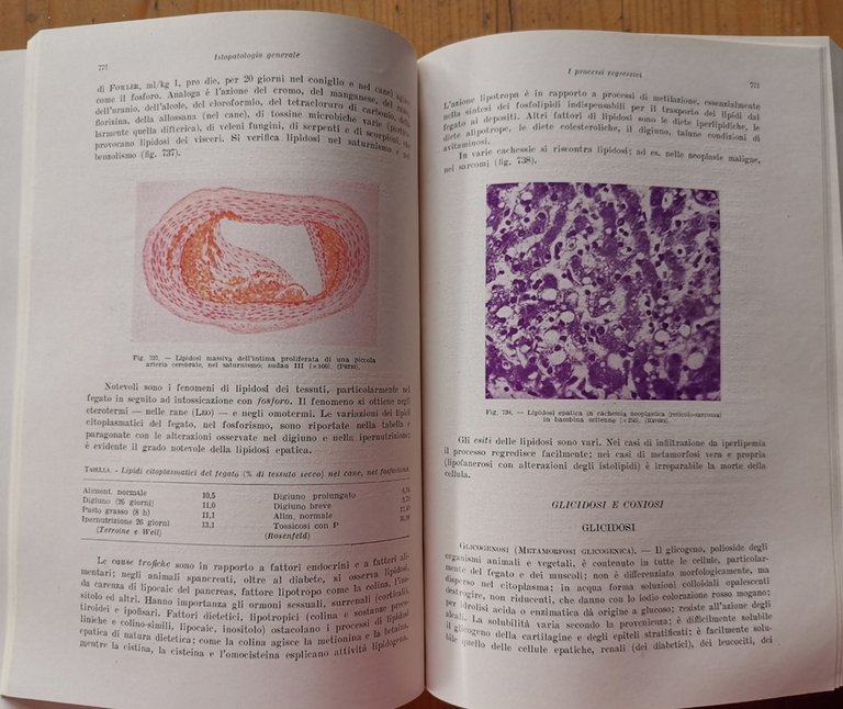 PATOLOGIA GENERALE. Parte I: Eziologia generale - Parte II: Istopatologia … | Immagine Gallery 4