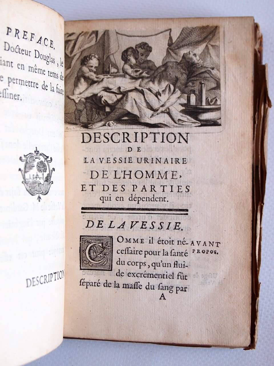 Description de la vessie urinaire de l'homme, et des parties …