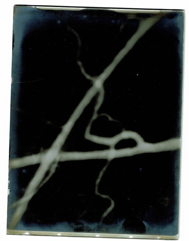Ensemble de six négatifs photographiques visualisant des hémorragies au microscope