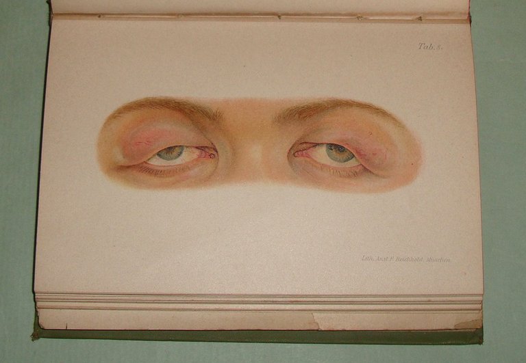 Atlante delle malattie esterne dell’occhio e principi fondamentali della loro …