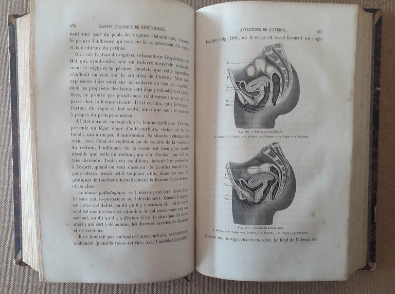 Manuel pratique de Gynécologie et des Maladies des Femmes