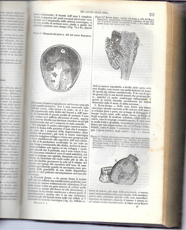 Elementi di patologia chirurgica, in 2 voll.
